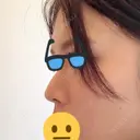 軟骨移植 フェアクリニック川口 AFTER サムネイル用