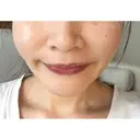 バッカルファット除去 / 脂肪吸引（顔） EMMA CLINIC（エマクリニック） DAY 31 サムネイル用