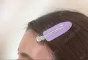 ボトックス（額） / 再生医療 クリニックビューティー恵比寿 DAY 6 サムネイル用