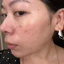 ルメッカ La Clinique Shinjuku 【ラクリニック 新宿】 DAY 0 サムネイル用