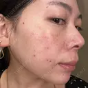 ルメッカ La Clinique Shinjuku 【ラクリニック 新宿】 DAY 0 サムネイル用