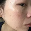 ルメッカ La Clinique Shinjuku 【ラクリニック 新宿】 DAY 5 サムネイル用