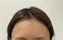 その他 ルラ美容クリニック 新宿院 DAY 1 サムネイル用