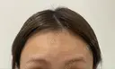 その他 ルラ美容クリニック 新宿院 DAY 1 サムネイル用