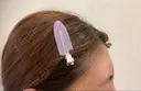 ボトックス（額） / 再生医療 クリニックビューティー恵比寿 DAY 14 サムネイル用