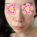 ルメッカ La Clinique Shinjuku 【ラクリニック 新宿】 AFTER サムネイル用