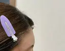 ボトックス（額） / 再生医療 クリニックビューティー恵比寿 DAY 24 サムネイル用
