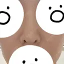 隆鼻術 / 鼻中隔延長（切開） / 小鼻縮小（切開） / 軟骨移植 / 鼻修正 / 鼻孔縁下降 FROM B整形外科 (旧バウム整形外科) DAY 28 サムネイル用