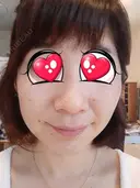 光治療（フォトフェイシャルなど） BMC CLINIC 南青山 DAY 66 サムネイル用