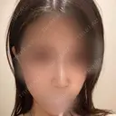 ヒアルロン酸注入（鼻） / ヒアルロン酸注入（あご） アクトリー勝どきウェルネスメディカルクリニック DAY 1 サムネイル用