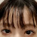 二重切開 こまちクリニック DAY 29 サムネイル用