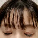 二重切開 こまちクリニック DAY 29 サムネイル用
