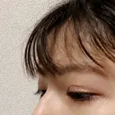 二重切開 こまちクリニック DAY 29 サムネイル用
