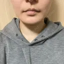 脂肪吸引（顔） THE CLINIC（ザ・クリニック） 福岡院 DAY 95 サムネイル用