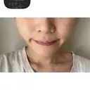バッカルファット除去 / 脂肪吸引（顔） EMMA CLINIC（エマクリニック） DAY 93 サムネイル用