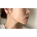 バッカルファット除去 / 脂肪吸引（顔） EMMA CLINIC（エマクリニック） DAY 93 サムネイル用