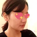 骨切り（あご） / 骨削り（エラ） / ルフォー+ssro（両あご) リラ・クラニオフェイシャル・クリニック DAY 24 サムネイル用