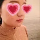 骨切り（あご） / 骨削り（エラ） / ルフォー+ssro（両あご) リラ・クラニオフェイシャル・クリニック DAY 16 サムネイル用