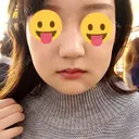 骨切り（あご） / 骨削り（エラ） / ルフォー+ssro（両あご) リラ・クラニオフェイシャル・クリニック DAY 11 サムネイル用