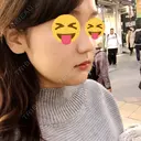 骨切り（あご） / 骨削り（エラ） / ルフォー+ssro（両あご) リラ・クラニオフェイシャル・クリニック DAY 11 サムネイル用