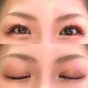 二重埋没 / 自然癒着法 シンデレラ＆ダヴィンチクリニック DAY 220 サムネイル用
