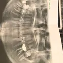 糸リフト / 骨切り（あご） / 脂肪吸引（顔） / ボトックス（エラ・小顔） 銀座マイアミ美容外科 AFTER サムネイル用