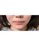 糸リフト / バッカルファット除去 / 脂肪吸引（顔） / 脂肪吸引（脚） / 脂肪吸引（お尻） / インディバ（お腹） 藤・ナチュレ美容クリニック 恵比寿院 DAY 21 サムネイル用