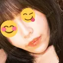 ヒアルロン酸注入（あご） ルラ美容クリニック 大宮院 / ルラスキンクリニック 大宮院 AFTER サムネイル用