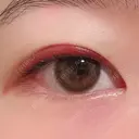 二重埋没 湘南美容クリニック 上野院 DAY 11 サムネイル用