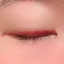 二重埋没 湘南美容クリニック 上野院 DAY 11 サムネイル用