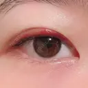 二重埋没 湘南美容クリニック 上野院 DAY 12 サムネイル用