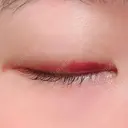 二重埋没 湘南美容クリニック 上野院 DAY 12 サムネイル用