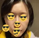 水光注射（ハリ・美肌） / 脂肪溶解注射（顔） / ヒアルロン酸注入（ほうれい線） / PRP皮膚再生療法 閉院｜プルージュ美容クリニック 赤羽院 DAY 14 サムネイル用
