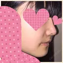 セットバック 大塚美容形成外科・歯科 大塚本院 DAY 35 サムネイル用