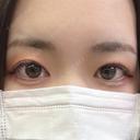 アートメイク（眉） 表参道ウィズ・クリニック DAY 4 サムネイル用