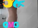二重埋没 / その他（目元） / 糸リフト / 脂肪吸引（顔） / その他（ボディ） / ジョールファット除去 / ボトックス（あご） / 脂肪溶解注射（お腹） / その他（口元） WOM CLINIC GINZA （ワム クリニック ギンザ） DAY 92 サムネイル用