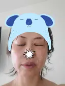 二重埋没 / その他（目元） / 糸リフト / 脂肪吸引（顔） / その他（ボディ） / ジョールファット除去 / ボトックス（あご） / 脂肪溶解注射（お腹） / その他（口元） WOM CLINIC GINZA （ワム クリニック ギンザ） AFTER サムネイル用