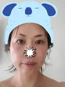 二重埋没 / その他（目元） / 糸リフト / 脂肪吸引（顔） / その他（ボディ） / ジョールファット除去 / ボトックス（あご） / 脂肪溶解注射（お腹） / その他（口元） WOM CLINIC GINZA （ワム クリニック ギンザ） DAY 92 サムネイル用