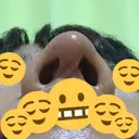 鼻尖形成（切開） / 鼻中隔延長（切開） / 軟骨移植 / 鼻尖縮小 / その他（鼻） ジョウクリニック 那覇院 DAY 9 サムネイル用