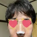 隆鼻術 / 軟骨移植 銀座S美容・形成外科クリニック DAY 4 サムネイル用