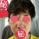 隆鼻術 / 軟骨移植 銀座S美容・形成外科クリニック DAY 6 サムネイル用