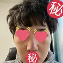 隆鼻術 / 軟骨移植 銀座S美容・形成外科クリニック DAY 9 サムネイル用