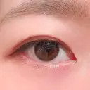 二重埋没 湘南美容クリニック 上野院 AFTER サムネイル用