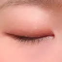 二重埋没 湘南美容クリニック 上野院 DAY 35 サムネイル用