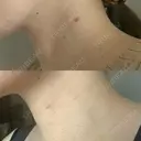 スネコス e:Top clinic（イートップクリニック） DAY 16 サムネイル用