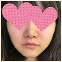 セットバック 大塚美容形成外科・歯科 大塚本院 DAY 38 サムネイル用