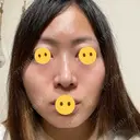 ヴェルヴェットスキン アリエル美容クリニック 大宮院 DAY 0 サムネイル用