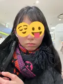 ボトックス（エラ・小顔） / ハイフ（顔） 大阪消化器内科・内視鏡クリニック難波院 DAY 1 サムネイル用