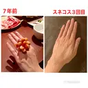 スネコス e:Top clinic（イートップクリニック） DAY 31 サムネイル用
