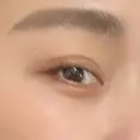 ヒアルロン酸注入（涙袋） HAAB×DREAM BEAUTY CLINIC 東京本院 AFTER サムネイル用